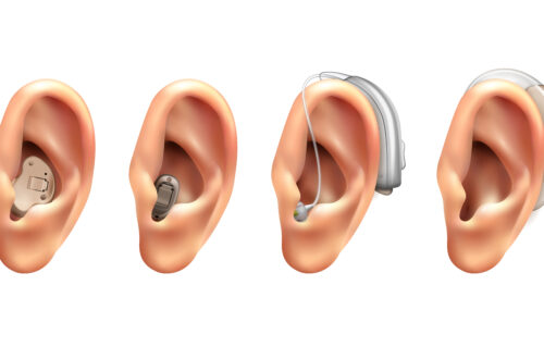 hearing aids, audiology